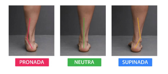 3 figuras mostrando os tipos de pisada, neutra, pronada e supinada